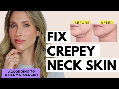 How to Fix Saggy Neck Skin | Dr. Sam Ellis