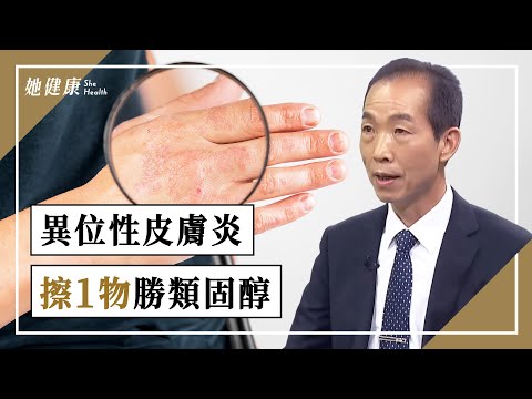 異位性皮膚炎 手肘窩、膝蓋後抓不停?4穴有效止癢!擦1物勝類固醇!掌握「7要訣」根治防復發!|林源泉 醫師|623