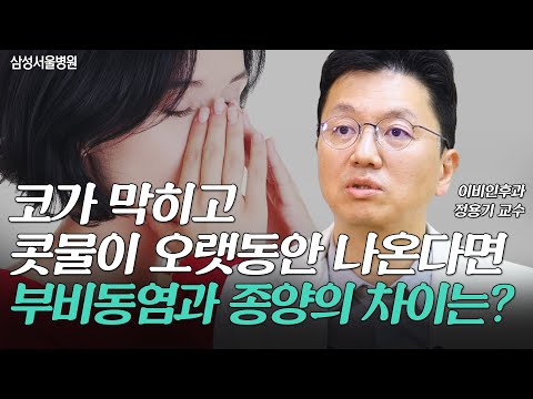 코가 막히고 누런 콧물이 오랫동안 나온다면ㅣ부비동염과 종양의 차이는? #이비인후과 정용기 교수