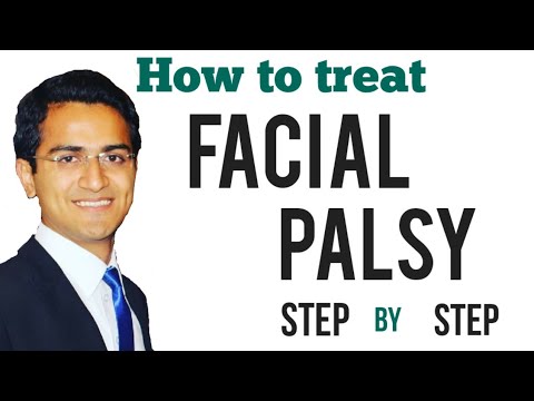 Facial palsy (Bell's Palsy) Treatment, Upper and Lower motor neuron (UMN vs LMN), Symptoms, USMLE