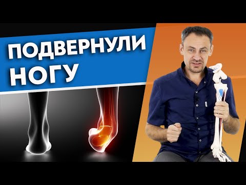 What is an ankle subluxation? / What to do if you have an ankle injury?