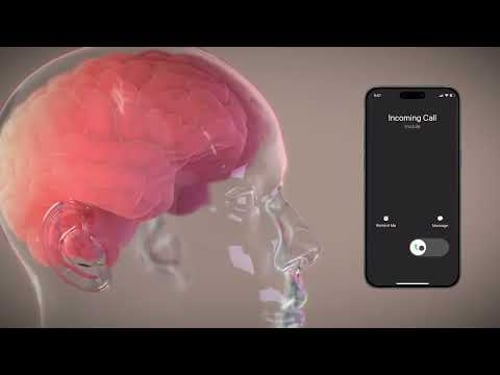 Neuralink’s Clinical Trial