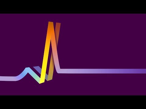 FLATLINE: How The Amiga Languished