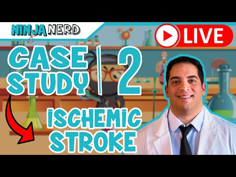 Case Study #2: Ischemic Stroke