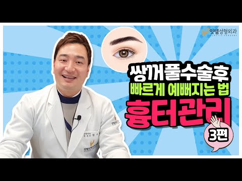 쌍수후 흉터관리 이런 설명은 없었다, 수술후 3개월 이렇게!!