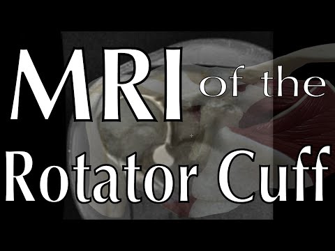 MRI of the Rotator Cuff