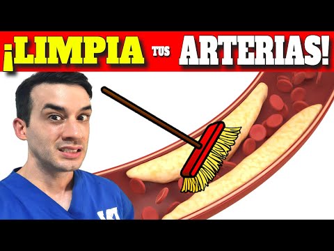 El INCREIBLE METODO que LIMPIA tus ARTERIAS RAPIDAMENTE! (Colesterol)