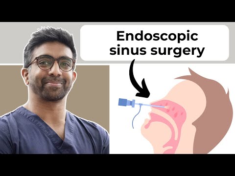 Nasal surgeon explains: What is endoscopic sinus surgery?