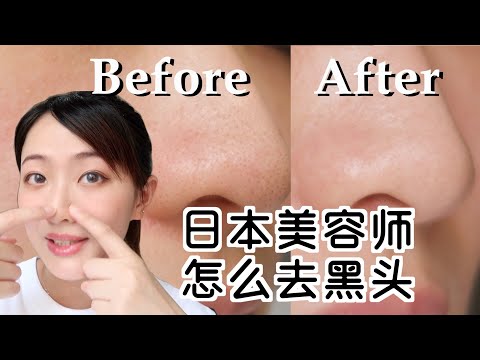 6分鐘告別草莓鼻 日本美容師教你正确去黑頭