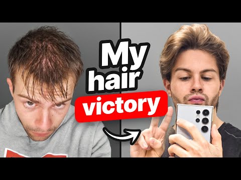 Why I STILL Havenโt Gone Bald After All These Years!